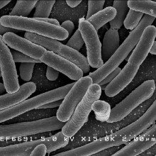 大肠杆菌:大肠杆菌的扫描电镜照片，在培养基中生长并粘附在盖片上。