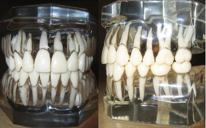 人类牙齿的模型，因为他们存在于牙槽骨