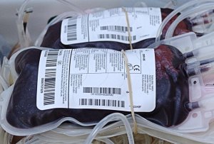 捐献时收集的袋装血液，呈深静脉血。