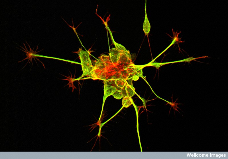新生神经细胞