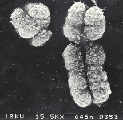 X & Y染色体