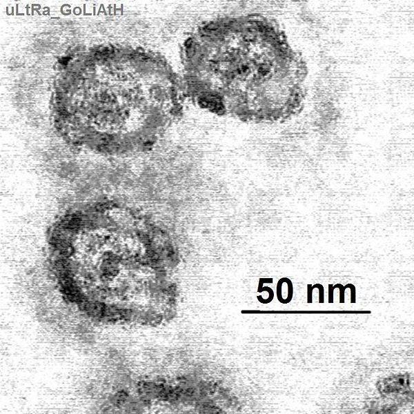 丙型肝炎病毒的电子显微镜