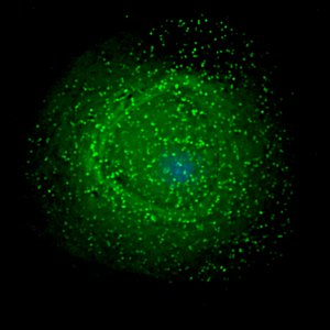 HIV-1颗粒聚集在被感染的巨噬细胞表面。