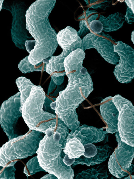 Campylobacter bacteria are the number-one cause of food-related gastrointestinal illness in the UK. This scanning electron microscope image shows the characteristic spiral, or corkscrew, shape and related structures.