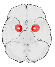 The figure shows the underside (ventral view) of a semi-transparent human brain, with the front of the brain at the top. The red blobs show the approximate location of the en:amygdala in the en:temporal lobes of the human brain. Note: the amygdala is...