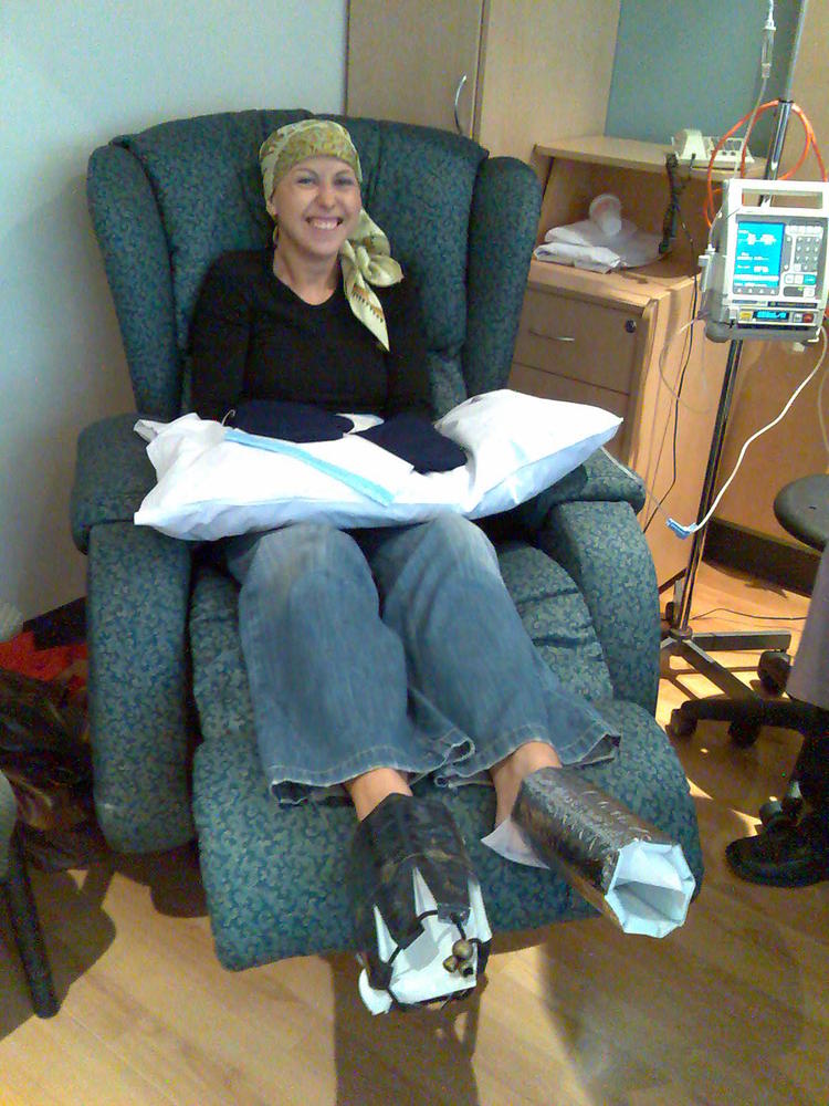This woman is being treated with docetaxel for breast cancer. Cooling mits and wine coolers are placed on her hands and feet to prevent deleterious effects on the nails. Similar strategies can be used to prevent hair loss.