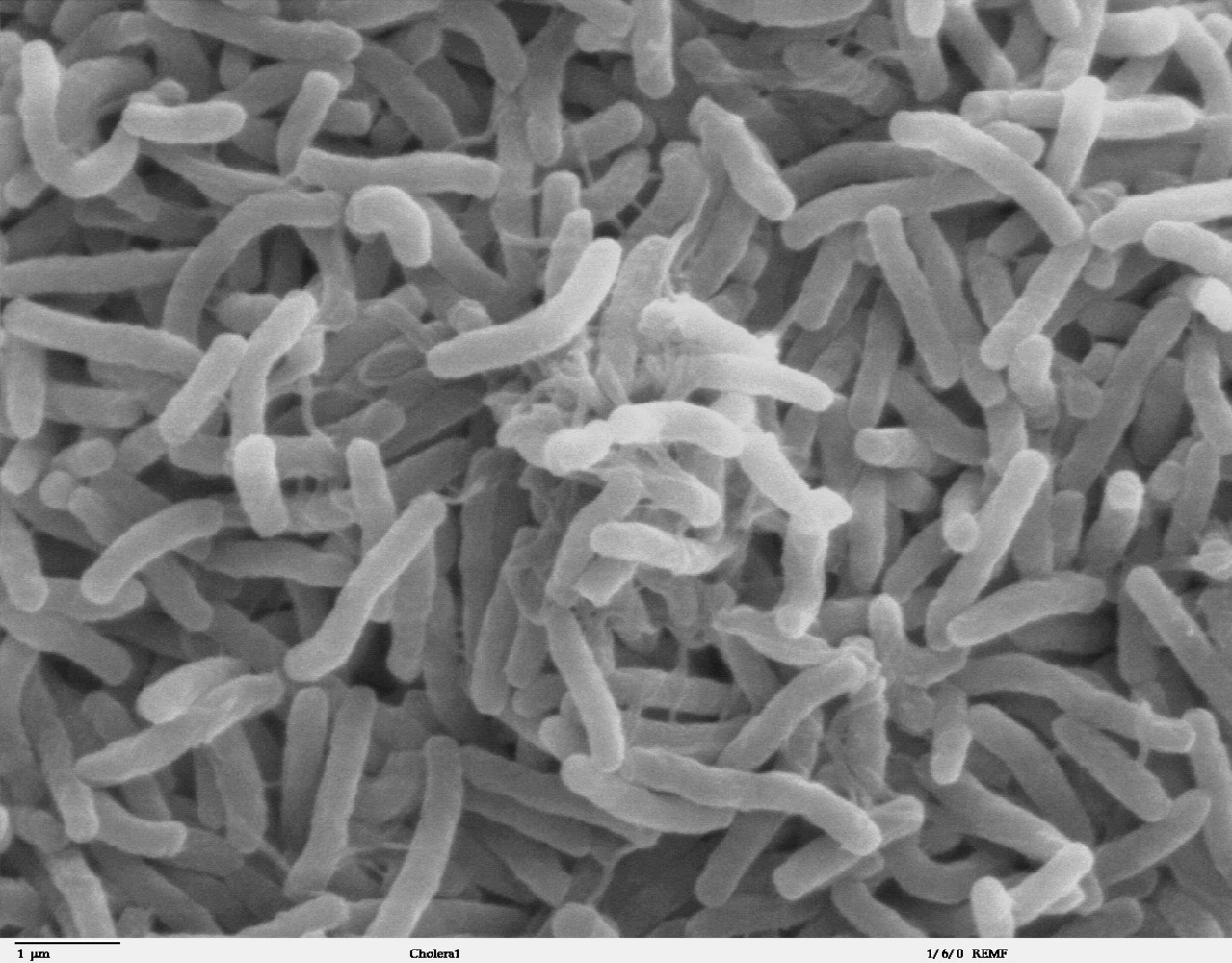 Scanning electron microscope image of Vibrio cholerae bacteria, which infect the digestive system.