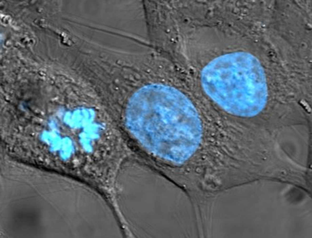 HeLa cells stained with Hoechst 33258 stain.