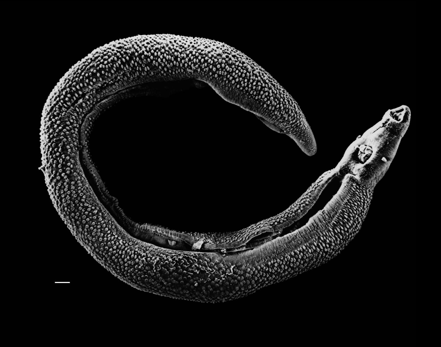 Electron micrograph of an adult male Schistosoma parasite worm. The bar (bottom left) represents a magnification of 0.5mm.