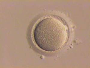 一个卵母细胞