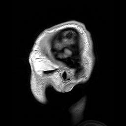人类头部的核磁共振成像图像的动态gif。