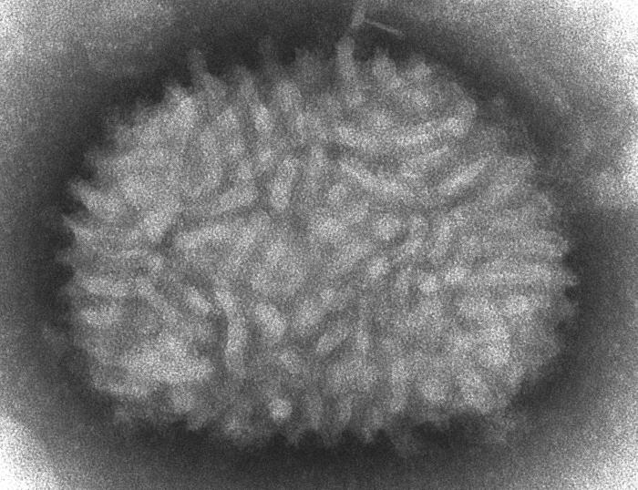 Vaccinia, a pox virus particle.