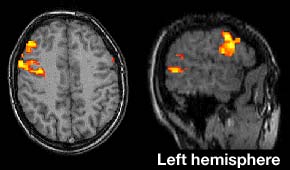 一些特定的任务是在大脑的独立区域处理的，只在一侧。在这张fMRI图像中，黄色的“热点”表示活跃的大脑区域。