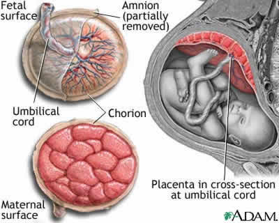 数字3 - The position and appearance of the placenta in situ, and after delivery. Image © ADAM.com