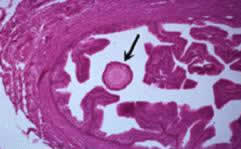 排卵后在输卵管中的犬卵(图片由康奈尔大学V.N.迈耶斯-沃伦博士提供)。