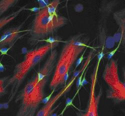 图2:由细胞培养的神经干细胞生成的神经细胞(绿色为神经元，红色为星形胶质细胞)。
