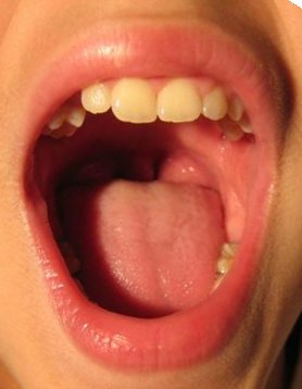 A mouth
