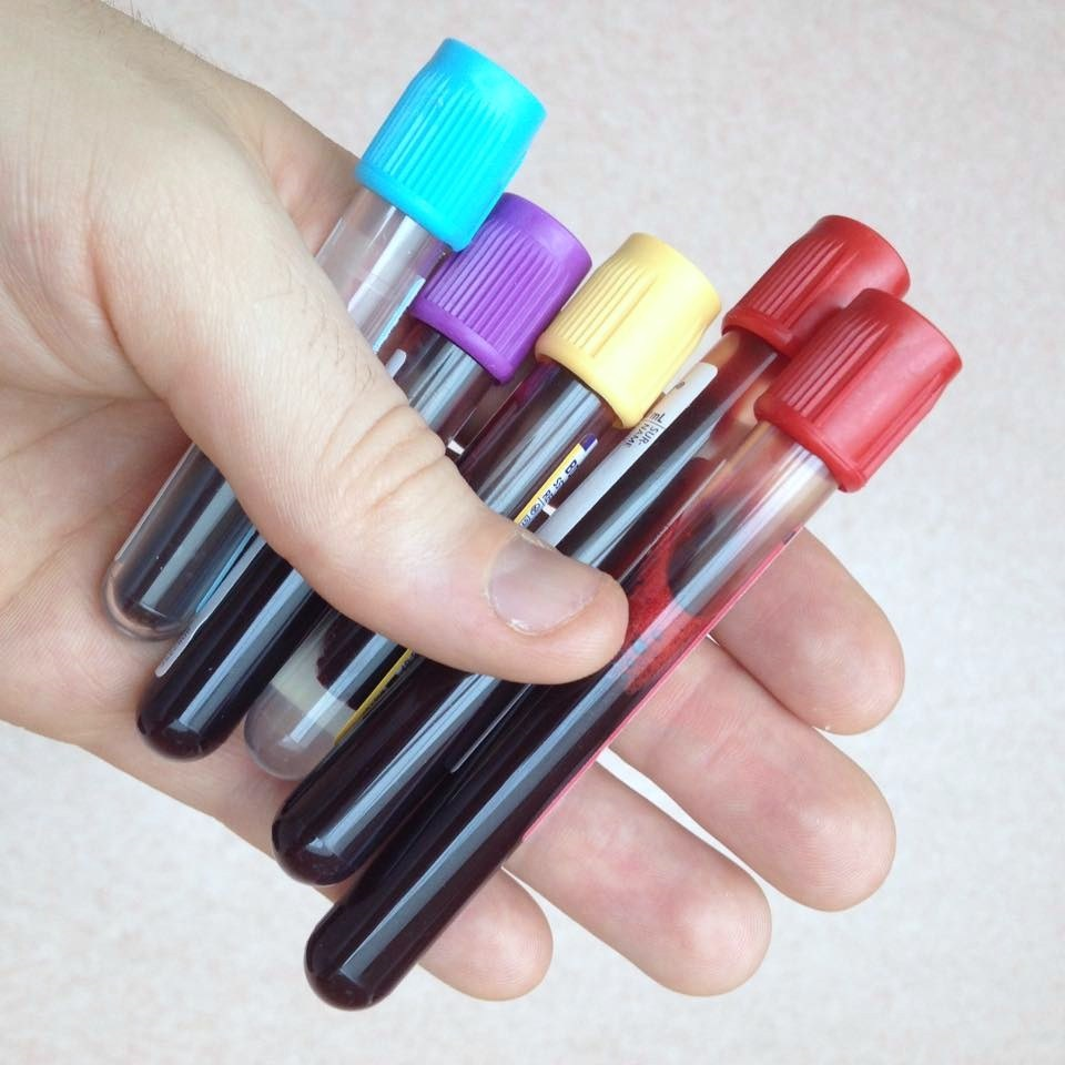 Tubes of blood for a blood test