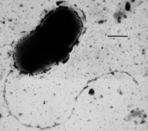 硫酸盐还原菌的透射电子显微照片;脱磷孤菌属寻常的