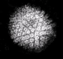 疱疹病毒的显微镜图像。