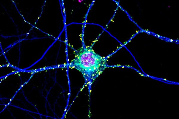 单细胞神经元