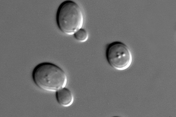 DIC显微镜下的酿酒酵母细胞。