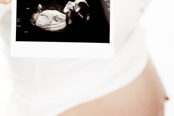 婴儿超声扫描