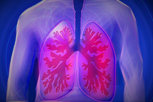 显示肺部动脉和静脉的图像。