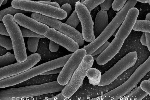 大肠杆菌的细菌