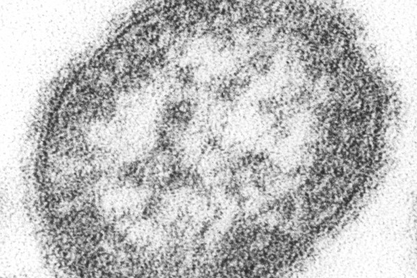 麻疹病毒颗粒(病毒粒子)麻疹病毒是麻疹病毒属的副粘病毒。该病毒直径100- 200nm，以单链RNA为核心，与牛瘟和犬瘟热病毒密切相关。