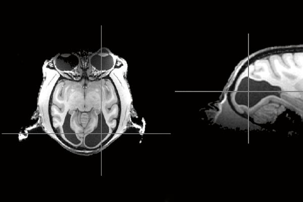 猴子的脑部扫描，仍然可以看到，但缺乏初级视觉皮层