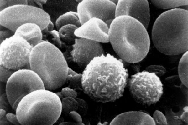 血细胞和血小板的电子显微镜