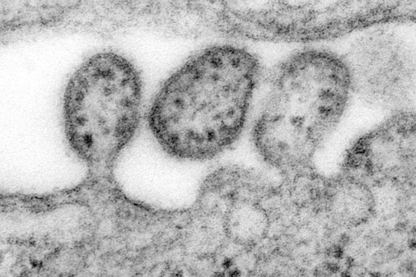Highly magnified transmission electron micrograph (TEM) depicted some of the ultrastructural details of a number of Lassa virus virions adjacent to some cell debris. The virus, a member of the virus family Arenaviridae, is a single-stranded RNA...