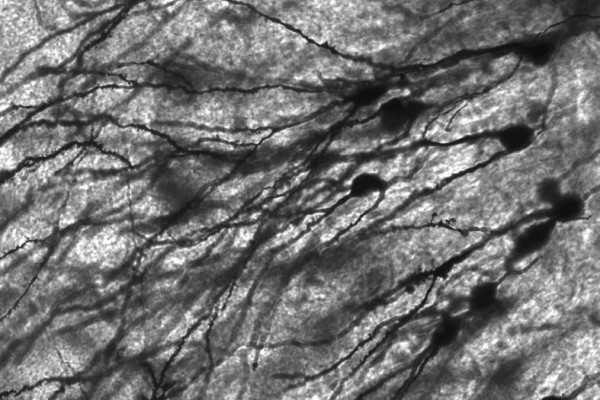 癫痫患者齿状回高尔基染色神经元图像。放大40倍。
