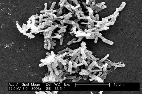 艰难梭菌(C.diff)在电子显微镜下的微生物