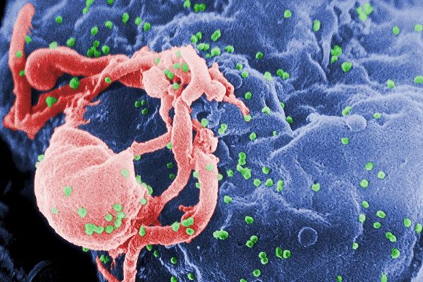 绿色的HIV病毒从淋巴细胞中出芽