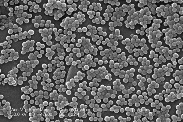这张2005年彩色扫描电子显微照片(SEM)描绘了许多耐甲氧西林金黄色葡萄球菌的团块，通常被简称为MRSA