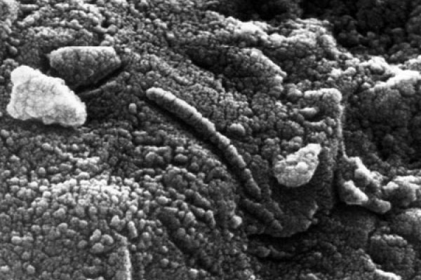 火星ALH84001陨石上类似细菌的结构
