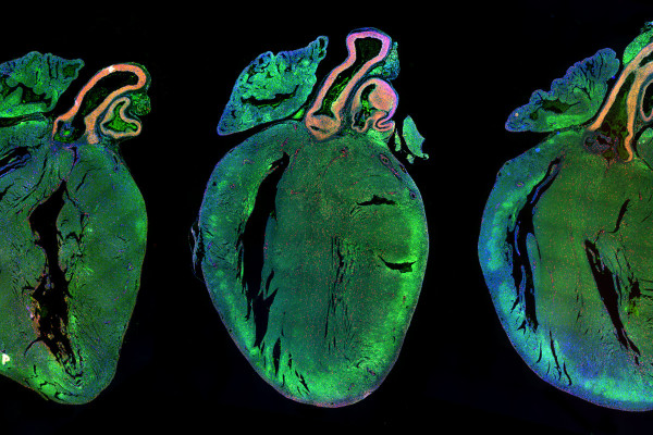用对照microRNA(左)或两个人类microRNA处理新生大鼠心脏，强烈增加心肌细胞增殖(中、右)。图中显示左侧肌肉团中有几个正在复制的(红色)细胞。