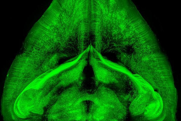 使用3DISCO -溶剂清除器官的3D成像技术可视化小鼠大脑中的神经元结构