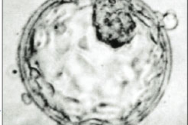 显示内细胞团(右上)和滋养外胚层的人囊胚图像。