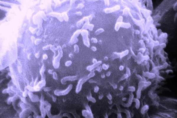 单个人淋巴细胞的电子显微镜图像。