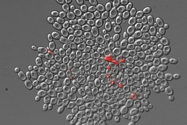 雪花状酵母簇，带有红色标记的死细胞。