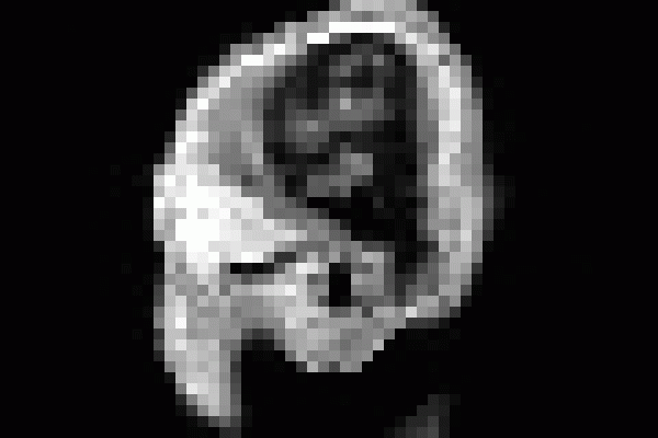 人类头部核磁共振成像的动态gif(较小)