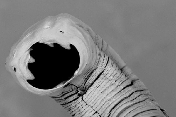 Hookworm: Necator americanus