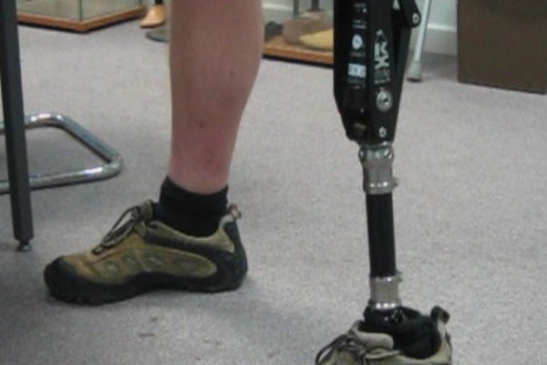 prosthetic_leg