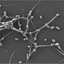 化脓性链球菌制造化学“鱼叉”将自己固定在宿主细胞上
