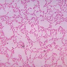 双孔拟杆菌，胃肠道中众多共生厌氧拟杆菌中的一种。