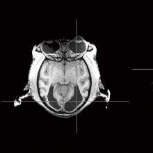 猴子的脑部扫描，仍然可以看到，但缺乏初级视觉皮层