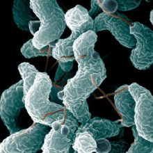 在英国，弯曲杆菌是导致与食物有关的胃肠道疾病的头号原因。这张扫描电子显微镜图像显示了典型的螺旋状，或螺旋状，形状和相关结构。